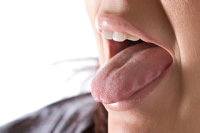 Сухость во рту (ксеростомия)